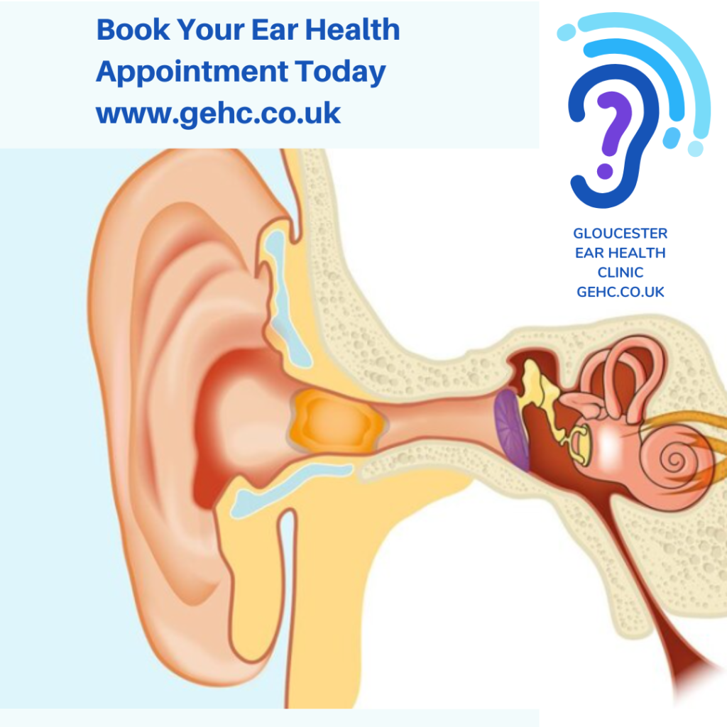 hearing screening (2)