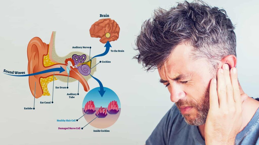 Causes of Ear Wax