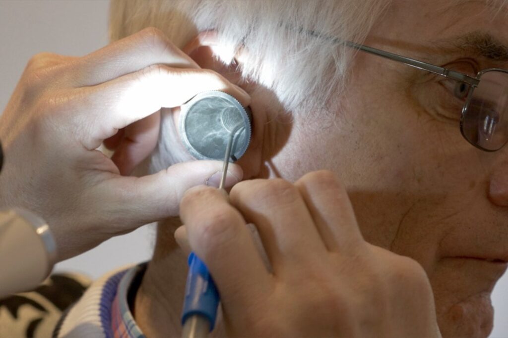 Microsuction Ear Wax Removal